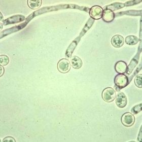 Ăn Gì Để Đào Thải Nấm Candida? Thực Phẩm Nên Ăn Và Cần Hạn Chế