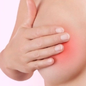 Áp Xe Vú Là Gì? Nguyên Nhân, Triệu Chứng Và Cách Điều Trị