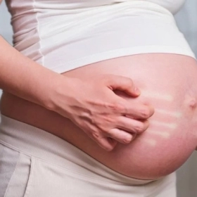 Bà Bầu Bị Nổi Mẩn Đỏ Ngứa Khắp Người: Nguyên Nhân Và Cách Xử Trí
