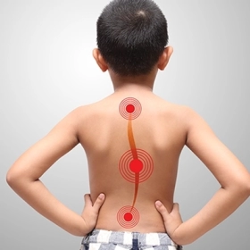 Bài Tập Cho Người Vẹo Cột Sống Giúp Cải Thiện Dáng Đứng Và Giảm Đau Hiệu Quả