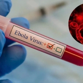 Bệnh Ebola Và Những Đại Dịch Từng Gây Chấn Động Thế Giới