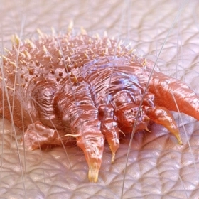 Bệnh Ghẻ Là Gì? Nguyên Nhân, Triệu Chứng Và Cách Điều Trị Hiệu Quả