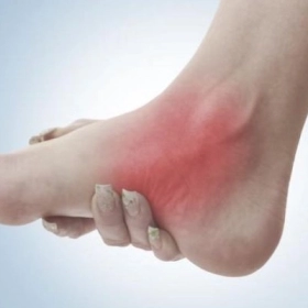 Bệnh Khớp Do Thần Kinh (Khớp Charcot): Dấu Hiệu Và Cách Điều Trị