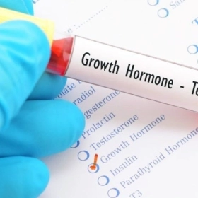 Bệnh Lùn Tuyến Yên: Nguyên Nhân, Dấu Hiệu Và Giải Pháp Điều Trị