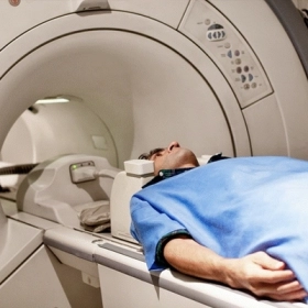 Bệnh Marchiafava-Bignami là gì? Nguyên nhân và cách điều trị