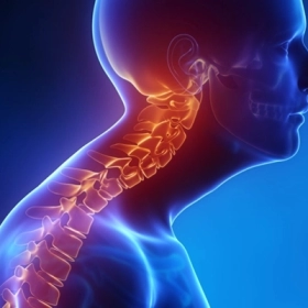 Bệnh Scheuermann: Nguyên Nhân, Triệu Chứng Và Cách Điều Trị