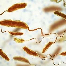 Bệnh Tả (Cholera): Dấu Hiệu Nhận Biết Và Phòng Ngừa
