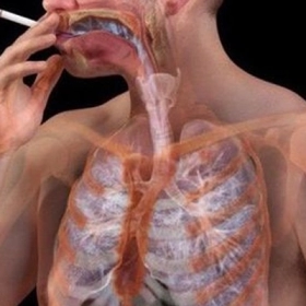 Bệnh Tích Protein Phế Nang: Dấu Hiệu Nhận Biết Và Hướng Điều Trị