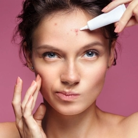 Benzoyl Peroxide Là Gì? Công Dụng, Cách Dùng Và Lưu Ý Khi Trị Mụn