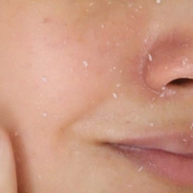 Bôi Kem Chống Nắng Bị Vón Cục: Nguyên Nhân Và Cách Khắc Phục