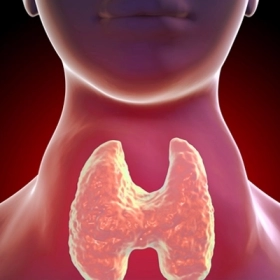 Bướu Giáp Đa Nhân Là Gì? Nguyên Nhân, Dấu Hiệu Và Cách Điều Trị