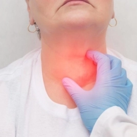 Bướu Giáp Lan Tỏa Là Gì? Nguyên Nhân, Triệu Chứng Và Điều Trị