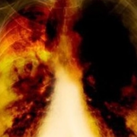 Các Loại Bệnh Bụi Phổi Thường Gặp: Bụi Silic, Than, Amiăng