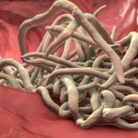 Cách Bắt Giun Kim Ở Hậu Môn Cho Người Lớn An Toàn Và Hiệu Quả