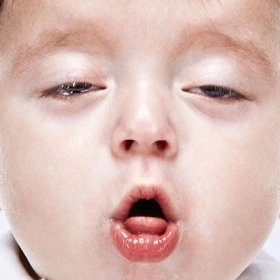 Cách Chữa Ho Sổ Mũi Cho Bé Bằng Dân Gian An Toàn, Dễ Áp Dụng