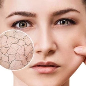 Cách nhận biết da thiếu ẩm: 7 dấu hiệu bạn cần biết