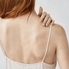Cách Trị Mụn Lưng Tại Nhà An Toàn Và Nhanh Chóng Cách Trị Mụn Lưng Tại Nhà An Toàn Và Nhanh Chóng