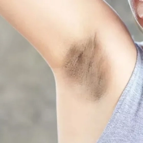 Cách Trị Thâm Nách Cho Bà Bầu An Toàn Tại Nhà Bằng Nguyên Liệu Tự Nhiên