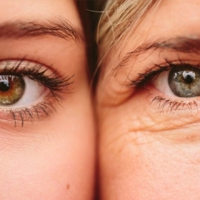 Cách Xóa Nếp Nhăn Vùng Mắt Tại Nhà Hiệu Quả Ngay Sau 4 Tuần