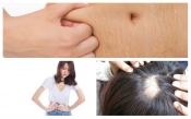 Chăm sóc bà mẹ trong thời kỳ hậu sản Chăm sóc bà mẹ trong thời kỳ hậu sản