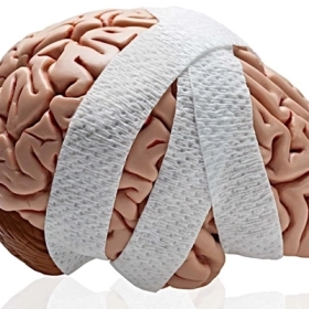 Chấn thương sọ não: Triệu chứng, nguyên nhân và cách xử trí