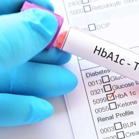 Chỉ Số HbA1c Bao Nhiêu Là Nguy Hiểm? Cách Kiểm Soát Hiệu Quả Chỉ Số HbA1c Bao Nhiêu Là Nguy Hiểm? Cách Kiểm Soát Hiệu Quả