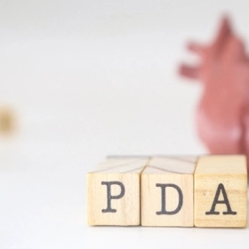 Còn Ống Động Mạch Là Gì? Nguyên Nhân, Triệu Chứng Và Cách Điều Trị Hiệu Quả