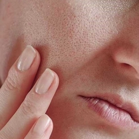 Da Mặt Dầu Bị Khô Bong Tróc: Nguyên Nhân Và Cách Khắc Phục