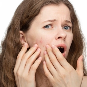Da Mặt Đột Nhiên Nổi Nhiều Mụn Là Dấu Hiệu Cảnh Báo Bệnh Gì?