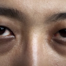 Đeo Kính Có Làm Mắt Bị Dại Không? Nguyên Nhân Và Cách Khắc Phục Hiệu Quả