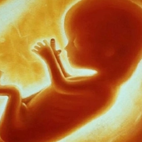 Dị tật ống thần kinh là gì? Nguyên nhân, phân loại và cách phòng ngừa