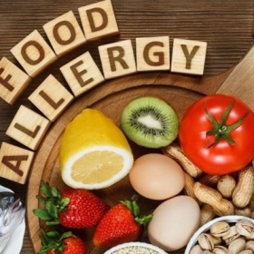 Dị Ứng Thức Ăn Có Nguy Hiểm Không? Khi Nào Cần Đi Bệnh Viện?