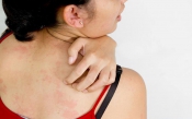 Dị ứng thực phẩm Dị ứng thực phẩm