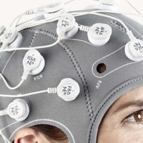 Điện não đồ là gì? Những điều bạn cần biết trước khi thực hiện