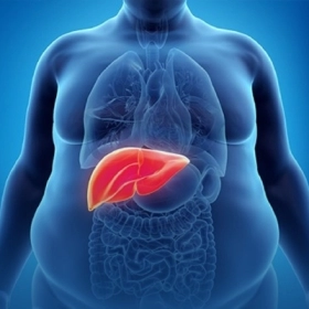 Gan Nhiễm Mỡ Có Nguy Hiểm Không? Mức Độ Nào Cần Điều Trị Ngay
