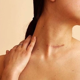 Giải Đáp: Bị Vết Thương Kiêng Ăn Gì Để Không Bị Sẹo Xấu?