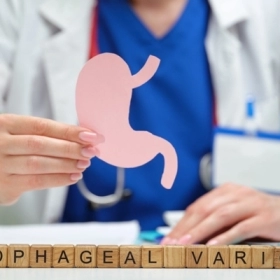 Giãn Tĩnh Mạch Thực Quản: Nguyên Nhân, Triệu Chứng Và Cách Điều Trị Hiệu Quả