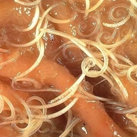 Giun Tóc Là Gì? Nguyên Nhân, Triệu Chứng, Chẩn Đoán Và Điều Trị Hiệu Quả