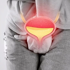 Hẹp niệu đạo: Nguyên nhân, triệu chứng và cách điều trị hiệu quả