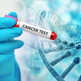 Hội chứng cận u: Dấu hiệu, nguyên nhân và cách điều trị