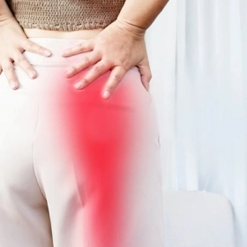 Hội Chứng Cơ Hình Lê Là Gì? Nguyên Nhân, Triệu Chứng Và Cách Điều Trị Hiệu Quả