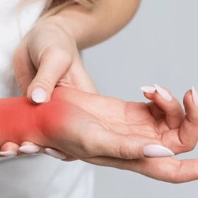 Hội Chứng De Quervain Là Gì? Nguyên Nhân, Triệu Chứng Và Cách Điều Trị