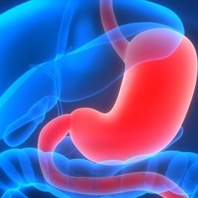 Hội Chứng Dumping: Nguyên Nhân, Triệu Chứng Và Cách Điều Trị Hiệu Quả