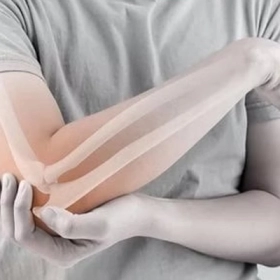 Hội Chứng Đường Hầm Xương Quay: Nguyên Nhân Và Cách Điều Trị