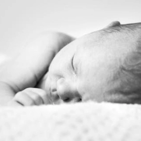 Hội Chứng Edwards Là Gì? Nguyên Nhân, Triệu Chứng Và Tiên Lượng Ở Trẻ