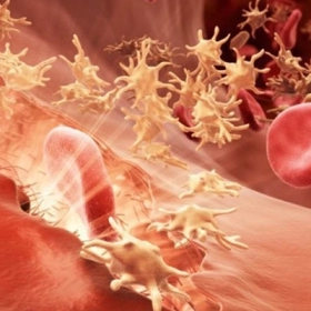 Hội Chứng Evans: Nguyên Nhân, Triệu Chứng Và Cách Điều Trị Hiệu Quả