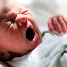 Hội Chứng Patau Là Gì? Nguyên Nhân, Triệu Chứng Và Tiên Lượng Ở Trẻ