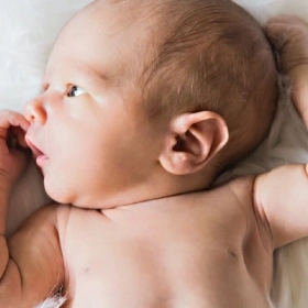 Hội Chứng Pierre Robin: Nguyên Nhân, Triệu Chứng Và Cách Điều Trị Hiệu Quả