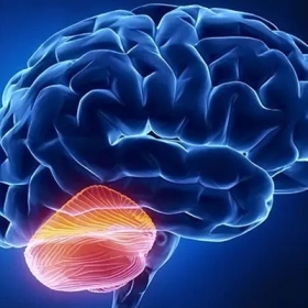 Hội Chứng Tiểu Não: Nguyên Nhân, Triệu Chứng Và Cách Điều Trị Hiệu Quả