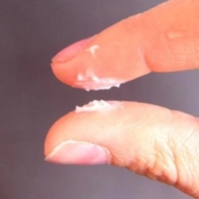 Khí Hư Bã Đậu Là Bị Gì? Nguyên Nhân Và Khi Nào Cần Đi Khám